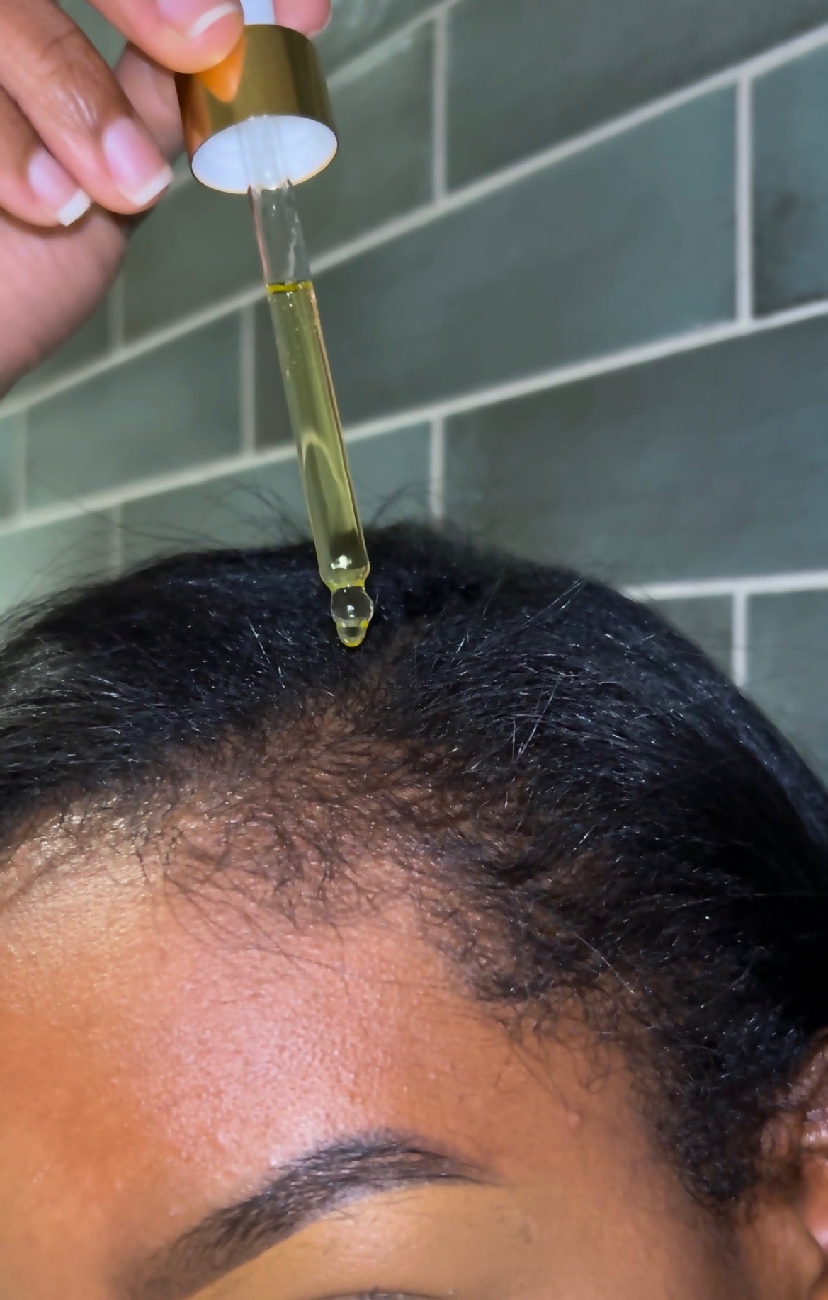 "tea tree -infused natural hair growth oil for dry scalp treatment and hair thickening."